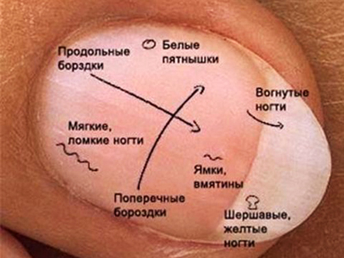 Диагностика организма по ногтям рук (аюрведа)